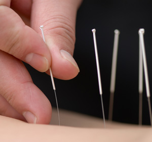 acupuncture and fatigue